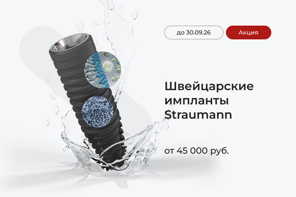 Импланты Straumann