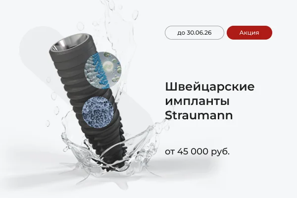 Импланты Straumann