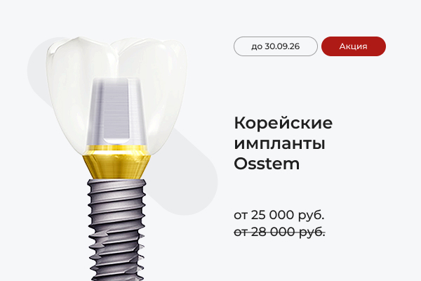 Импланты Osstem